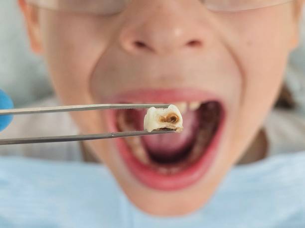 Best Weekend Emergency Dentist in Atkins, IA